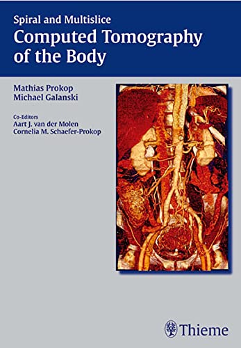 Stock image for Spiral and Multislice Computed Tomography of the Body for sale by BooksRun