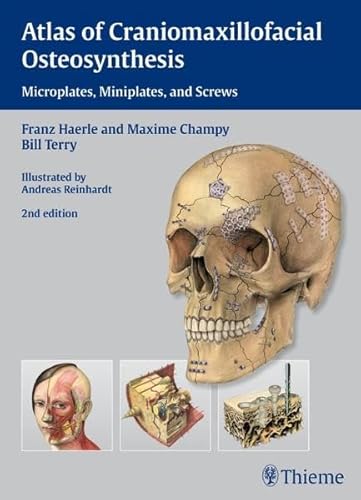 Atlas of Craniomaxillofacial Osteosynthesis - Franz Härle