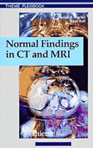 Imagen de archivo de Normal Findings in CT and MRI ZusArb Torsten B Mller, Emil R Reif 210 Illustrations Thieme Flexibook a la venta por PBShop.store UK