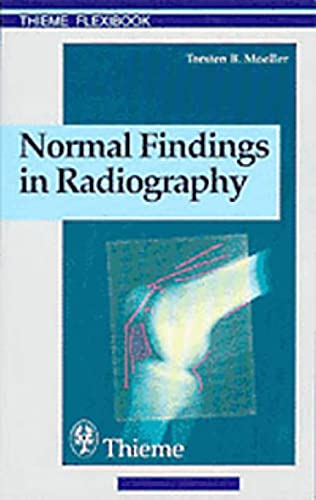 9783131165312: Normal Findings in Radiography (Thieme flexibook): . Zus.-Arb.: Torsten B. Mller Translated by Terry Telger 190 Illustrations