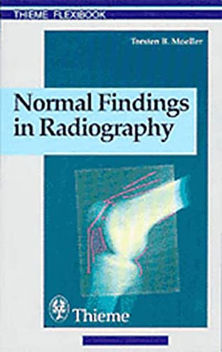 Stock image for Normal Findings in Radiography: . Zus.-Arb.: Torsten B. Mller Translated by Terry Telger 190 Illustrations (Thieme Flexibook) for sale by The Book Spot