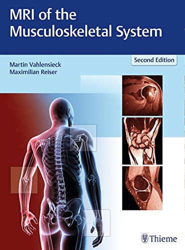 9783131165725: MRI of the Musculoskeletal System