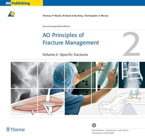 Beispielbild fr AO Principles of Fracture Management: Vol. 1: Principles, Vol. 2: Specific fractures zum Verkauf von SecondSale