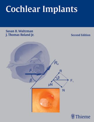 Beispielbild fr Cochlear Implants von Susan B. Waltzman (Autor), Noel L. Cohen zum Verkauf von BUCHSERVICE / ANTIQUARIAT Lars Lutzer