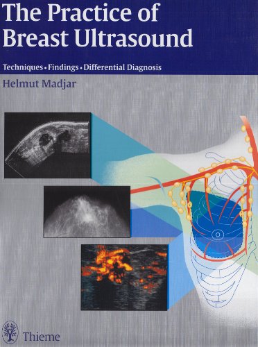 9783131243416: The Practice of Breast Ultrasound