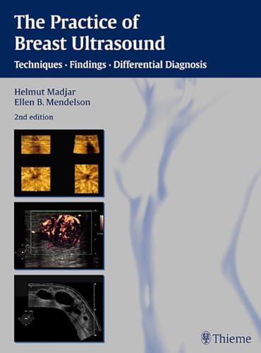 9783131243423: The Practice of Breast Ultrasound: Techniques, Findings, Differential Diagnosis