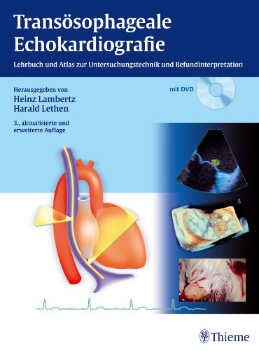 Stock image for Transsophageale Echokardiografie: Lehrbuch und Atlas zur Untersuchungstechnik und Befundinterpretation for sale by Volker Ziesing