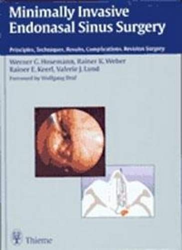 Stock image for MINIMALLY INVASIVE ENDONASAL SINUS SURGERY: PRINCIPLES, TECHNIQUES, RESULTS, COMPLICATIONS, REVISION SURGERY 1/E for sale by Romtrade Corp.