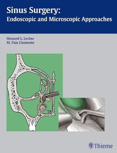 Imagen de archivo de Sinus surgery : endoscopic and microscopic approaches. a la venta por CSG Onlinebuch GMBH