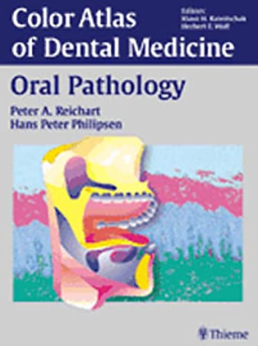 Stock image for Color Atlas Of Dental Medicine - Oral Pathology for sale by Basi6 International