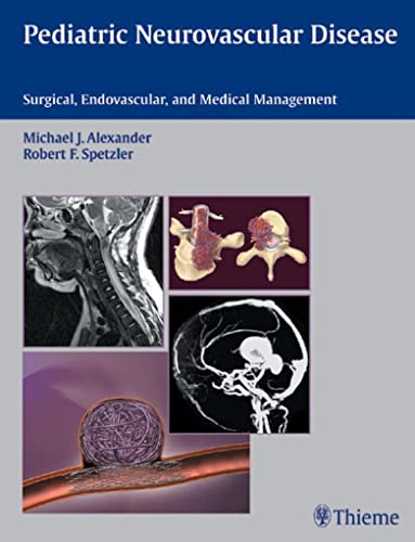 Pediatric Neurovascular Disease (9783131266118) by Michael J. Alexander; Robert F. Spetzler