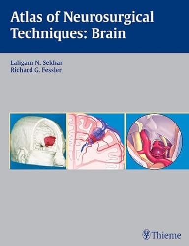 9783131275417: Atlas of Neurosurgical Techniques: Brain