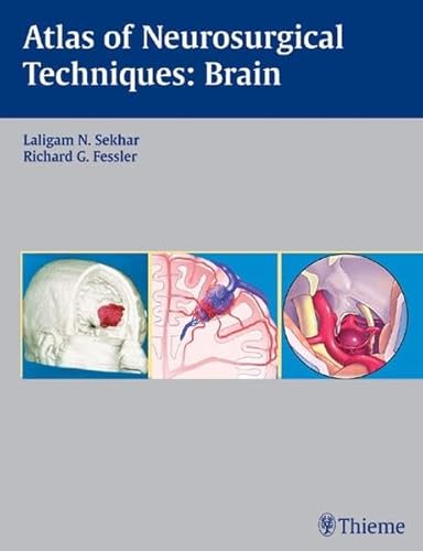 9783131275417: Atlas of Neurosurgical Techniques. Brain