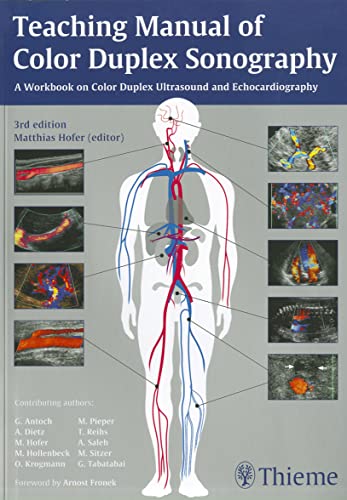 Beispielbild fr Teaching Manual of Color Duplex Sonography zum Verkauf von Blackwell's