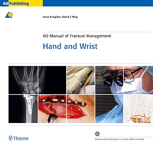 9783131276117: AO Manual of Fracture Management: Hand and Wrist, Book & DVD (AO-Publishing)