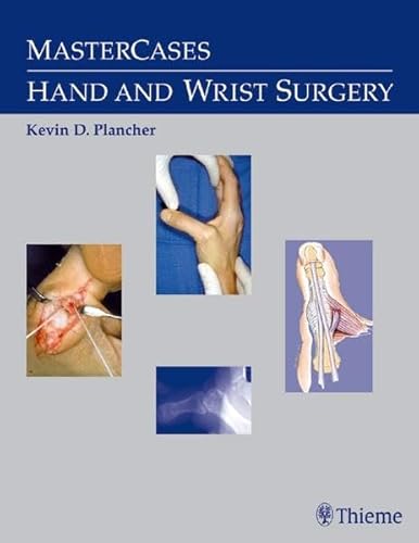 9783131277411: MasterCases in Hand and Wrist Surgery