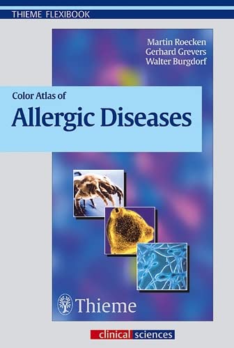 9783131291912: Color Atlas of Allergic Diseases (Thieme Flexibook)