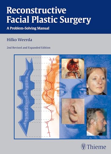 9783131296429: Reconstructive Facial Plastic Surgery: A Problem-Solving Manual