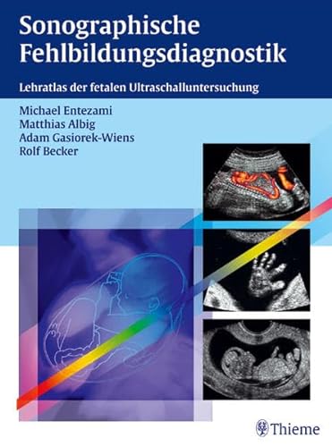 9783131296511: Sonographische Fehlbildungsdiagnostik: Lehratlas der fetalen Ultraschalluntersuchung