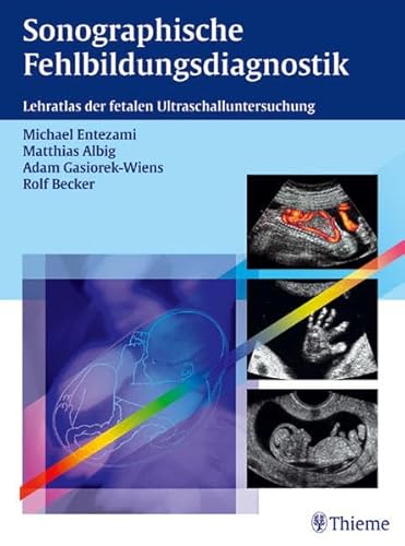 Imagen de archivo de Sonographische Fehlbildungsdiagnostik: Lehratlas der fetalen Ultraschalluntersuchung (Gebundene Ausgabe) Michael Entezami Matthias Albig Adam Gasiorek-Wiens Rolf Becker Fehlbildung Missbildung Prnatale Diagnostik Echodiagnostik Gynkologie Geburtshilfe Klinik Praxis Radiologie Bildgebende Verfahren Sonographie Echokardiographie Studium 2. Studienabschnitt Klinik Frauenheilkunde Ftus Medizin Klinische Fcher Missbildung Bildband Missbildungen Mibildungen Pdiatrie Schwangerschaft Ultraschalldiagnostik Sicherheit in der Schwangerenvorsorge. Schritt halten mit den gestiegenen Anforderungen. Beschreibung Lehrbuch und Atlas zugleich; Rascher Wissenszugriff durch befundorientiertes und abbildungsbetontes Konzept; ber 140 "Steckbriefe" und ber 80 eindrckliche Nativabbildungen; Prgnante Legenden; Durchgehend einheitliches KapitelrasterDefinition, sonomorphologische Kriterien, Begleitfehlbildungen, Wiederholungsrisiko etc. Unmittelbare Praxisnhe Systematisches Vorgehen und detaillierte a la venta por BUCHSERVICE / ANTIQUARIAT Lars Lutzer