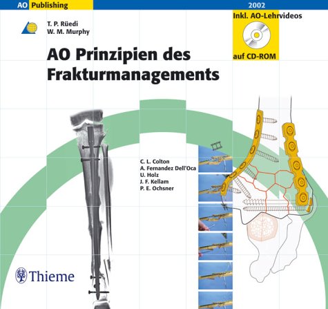 Beispielbild fr AO Prinzipien des Frakturmanagements Inklusive 2 CD-ROM mit AO-Lehrvideos [Gebundene Ausgabe] Tomas P. Redi William M. Murphy Chris L Colton, Alberto Fernandez Dell'Oca, Ulrich Holz, James F Kellam, Peter E Ochsner (Herausgeber) 617 Abb. in 1672 meist farb. Einzeldarst., 29 Tab., 2 CD-ROM Bewegungsapparat Medizin Klinische Fcher Knochenbruch Orthopdie Osteosynthese Umfassender Text mit zustzlichen und deutlich hervorgehobenen Merkstzen - CD-ROM - Die beigelegten CD-ROMs bieten eine umfassende Auswahl von AO-Lehrvideos an. Diese ermglichen es Ihnen, sich auf verschiedene Abschnitte zu konzentrieren - Das Kapitel zu den speziellen Frakturen wird durch Sequenzen von praktischen bungsvideos untersttzt, die sich auf die verschiedenen Regionen des Skeletts beziehen wie Humerus, Becken, Femur, Tibia etc - Als Navigationshilfen bieten sich Hyperlinks, elektronische Buchzeichen und Volltextsuche an - Die Internet-Plattform bietet Ihnen Aktualisierungen, bibliographische Angaben und zus zum Verkauf von BUCHSERVICE / ANTIQUARIAT Lars Lutzer