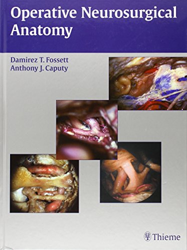 9783131299512: Operative Neurosurgical Anatomy