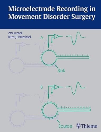 9783131300416: Microelectrode Recording in Movement Disorder Surgery