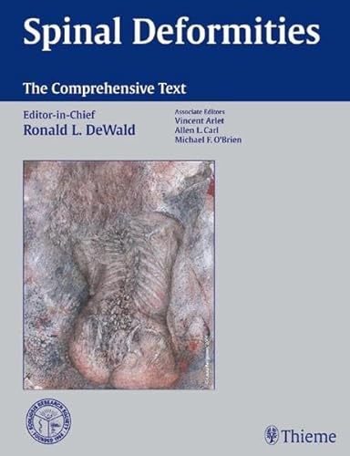 9783131305510: Spinal Deformities: The Comprehensive Text
