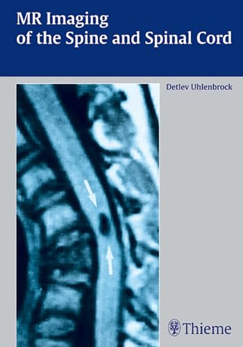 Imagen de archivo de MR Imaging of the Spine and Spinal Cord a la venta por PBShop.store UK