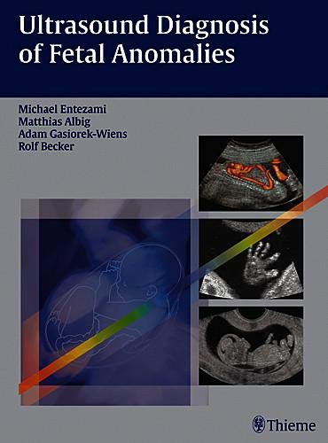 Imagen de archivo de Ultrasound Diagnosis of Fetal Anomalies a la venta por Better World Books Ltd