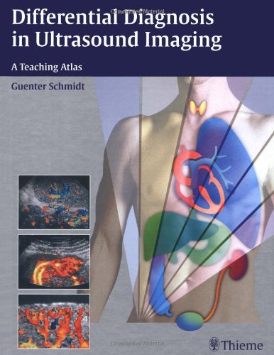 Differential Diagnosis in Ultrasound Imaging (9783131318916) by SCHMIDT