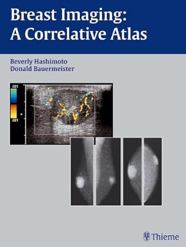 Stock image for Breast Imaging A Correlative Atlas Bildgebende Verfahren Brusterkrankung Brust weibl. Mamma Brust weibliche Chirurgie Allgemeinmedizin Frauenheilkunde Gynkologie Humanmedizin Klinische Fcher Mammographie Radiologie Radiologe Atlas Medizin Pharmazie Medizinische Fachgebiete for sale by BUCHSERVICE / ANTIQUARIAT Lars Lutzer