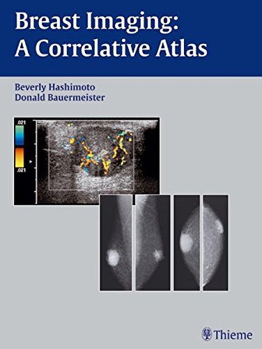 9783131319517: Breast Imaging: A Correlative Atlas