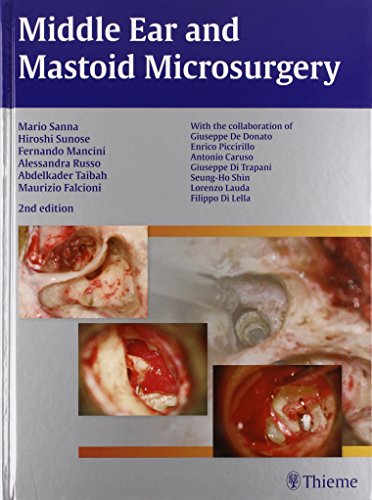 Beispielbild fr Middle Ear and Mastoid Microsurgery zum Verkauf von GF Books, Inc.