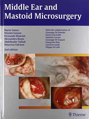 9783131320926: Middle Ear and Mastoid Microsurgery