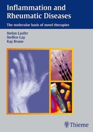 Stock image for Inflammation and Rheumatic Diseases: The Molecular Basis of Novel Therapies Laufer, Stefan; Gay, Steffen and Brune, Kay for sale by online-buch-de