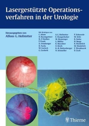 Beispielbild fr Lasergesttzte Operationsverfahren in der Urologie (Gebundene Ausgabe) von Alfons G. Hofstetter zum Verkauf von BUCHSERVICE / ANTIQUARIAT Lars Lutzer