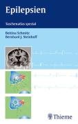 9783131335814: Epilepsien: Taschenatlas spezial