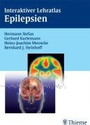 Beispielbild fr Interaktiver Lehratlas Epilepsien. CD-ROM. [Audio CD] Neurologie Anfallsleiden DVD Epilepsie Epileptiker Gehirn Epilepsiechirurgie Epilepsie-Anamnese, EEG, Neuroimaging, properative Diagnostik Effektiv therapieren Therapie des ersten Anfalls, Medikamentenauswahl, Mono- und Kombinationstherapie u.a. Beratung fr Patienten Beschreibung Schlagzeile Richtig diagnostizieren Hermann Stefan (Autor), Gerhard Kurlemann (Autor), Heinz-Joachim Meencke Joachim Schuster, Marcus Bieser Thieme CD-ROM Epilepsien gehren heute zu den gut behandelbaren Erkrankungen - vorausgesetzt sie werden richtig erkannt und therapiert. Dieser Lehratlas bietet einen Einblick in die Pathophysiologie der Epilepsien, ihre Klassifikation und Differenzialdiagnose, die Prinzipien der medikamentsen Therapie sowie die Mglichkeiten der Epilepsiechirurgie. Die Darstellung erfolgt anhand von zahlreichen Abbildungen und Animationen. Der Schwerpunkt des Programms liegt auf 13 Fallbeispielen, in denen epileptische und nichtepil zum Verkauf von BUCHSERVICE / ANTIQUARIAT Lars Lutzer