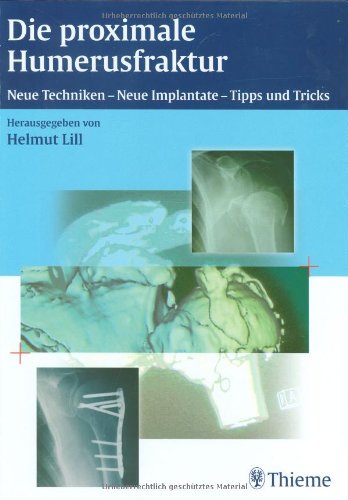 Beispielbild fr Die proximale Humerusfraktur: Neue Techniken, Neue Implantate - Tipps und Tricks [Gebundene Ausgabe] von Helmut Lill zum Verkauf von BUCHSERVICE / ANTIQUARIAT Lars Lutzer