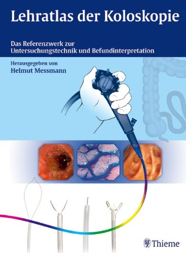 Stock image for Lehratlas der Koloskopie: Das Referenzwerk zur Untersuchungstechnik und Befundinterpretation (Gebundene Ausgabe) von Helmut Messmann interventionelle Koloskopie Polypektomie Mukosektomie Tumortherapie Fremdkrperentfernung Fisteltherapie Nahtinsuffizienzen Indikationen Erfolgsraten der verschiedenen Therapieoptionen Blutstillung durch Thermokoagulation Injektion mechanische Methoden Professionelle Bild- und Videodokumentation EDV-gesttzten Befundung for sale by BUCHSERVICE / ANTIQUARIAT Lars Lutzer