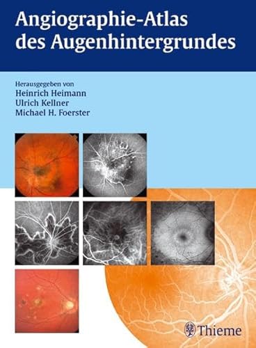 Angiographie- Atlas des Augenhintergrundes (Gebundene Ausgabe) Augenheilkunde Angiographie Augenerkrankung Augenheilkunde Augenhintergrund Angiographie-Atlas Fluoreszenz Fluoreszenzangiographie Intraokular Okulär Ophthalmologie Augenkrankheit Augen Auge Angiografie Heinrich Heimann (Autor), Ulrich Kellner (Autor), Michael H. Foerster - Heimann, Heinrich Kellner, Ulrich Foerster, Michael H. Nikolaos Bechrakis, Jan Breckwoldt, Faik Gelisken, Horst Helbig, Werner Inhoffen, Claudia Jandeck, Lothar Krause, Klaus-Martin Kreusel, Andreas Schüler, Joachim Wachtlin Michael H. Foerster, Heinrich Heimann, Ulrich Kellner