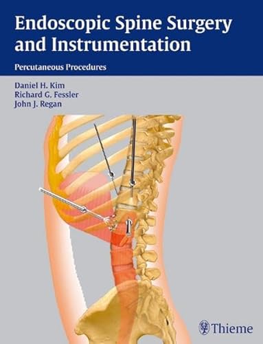 9783131366511: Endoscopic Spine Surgery and Instrumentation