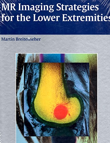 9783131367815: MR Imaging Strategies for the Lower Extremities