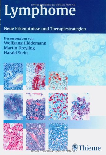 Beispielbild fr Lymphome: Neue Erkenntnisse und Therapiestrategien von Wolfgang Hiddemann (Herausgeber), Martin Dreyling (Herausgeber), Harald Stein (Herausgeber) Neue Erkenntnisse und Therapiestrategien. Ein umfassender berblick ber alle bsartigen Tumore, Lymphknotenvergrerungen und -schwellungen- Ursachen und Diagnostik von Lymphomen - Risikofaktoren - Klassifikation und Stadieneinteilung - Therapieformen. Mit ausfhrlichem Bildteil und Sachverzeichnis. zum Verkauf von BUCHSERVICE / ANTIQUARIAT Lars Lutzer