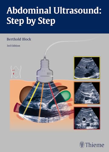 Beispielbild fr Abdominal Ultrasound zum Verkauf von Blackwell's