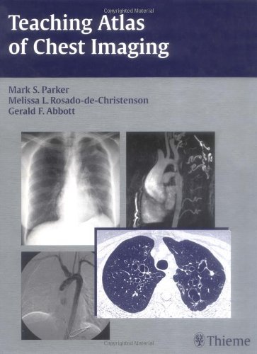 9783131390219: Teaching Atlas of Chest Imaging