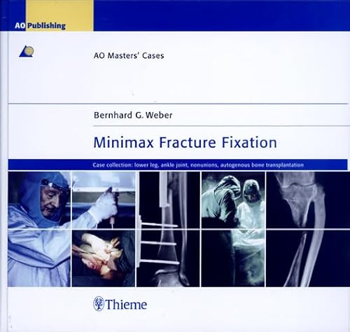 Stock image for MINIMAX FRACTURE FIXATION: CASE COLLECTION:LOWER LEG ANKLE AO MASTER CASES for sale by Romtrade Corp.