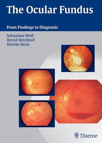 Stock image for The Ocular Fundus: From Findings to Diagnosis for sale by Mispah books