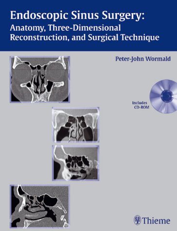 Beispielbild fr Endoscopic Sinus Surgery: Anatomy, Three-Dimensional Reconstuction and Surgical Technique (Gebundene Ausgabe) von Peter-John Wormald zum Verkauf von BUCHSERVICE / ANTIQUARIAT Lars Lutzer